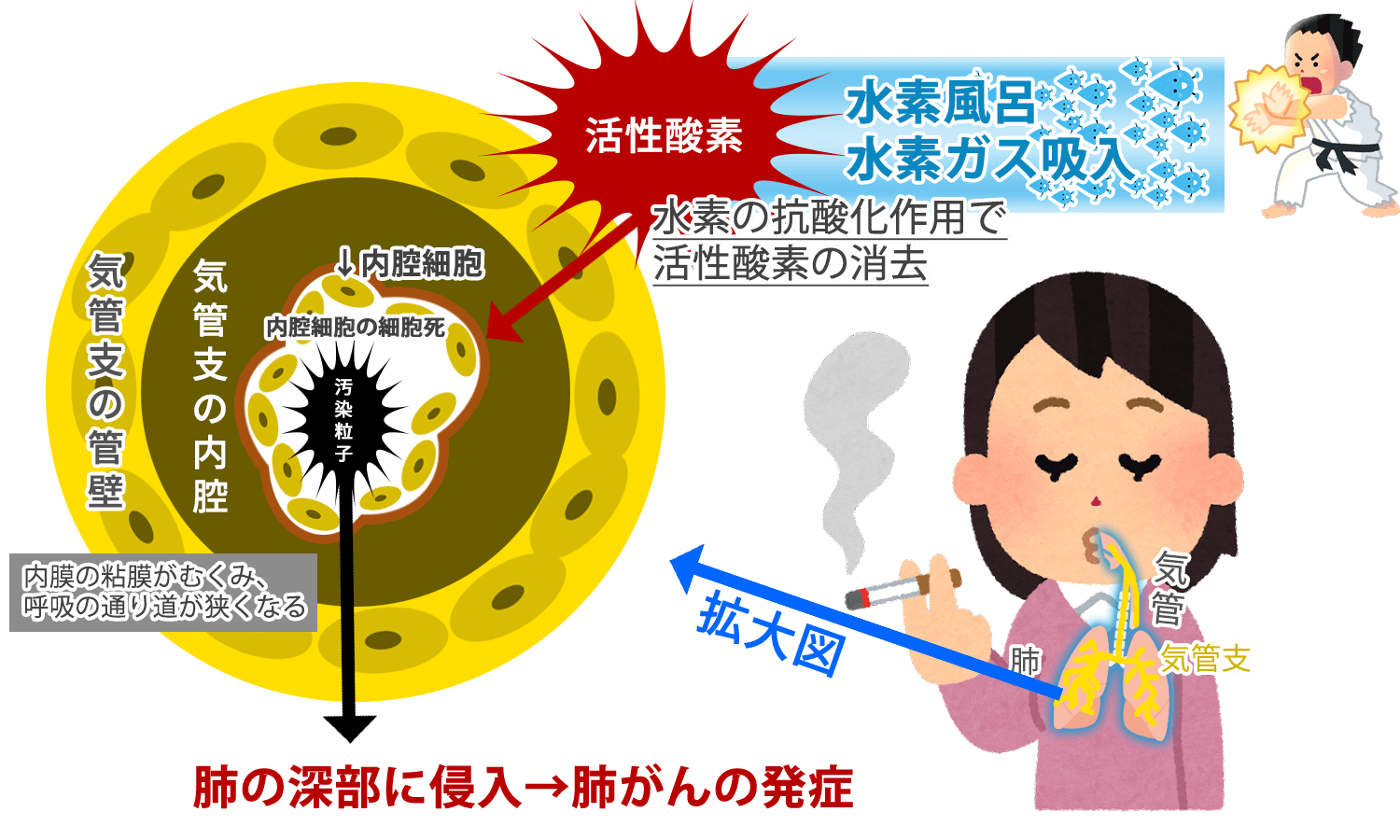 水素ガス・水素風呂で肺がん・肺障害から守る！